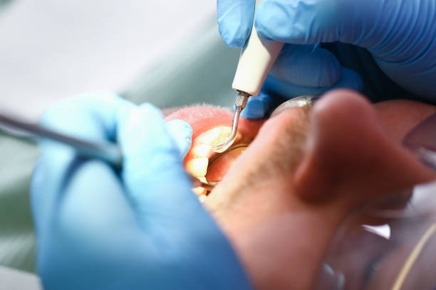 Best Emergency Root Canal Therapy in Maypearl, TX