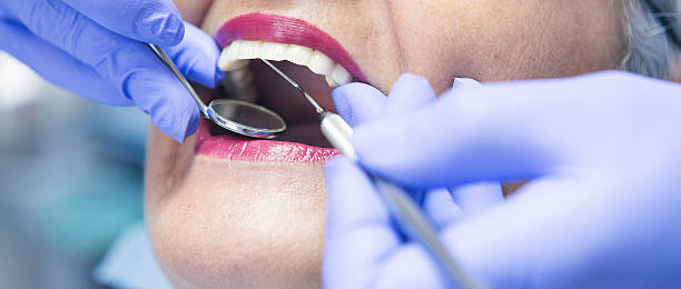 Best Broken or Chipped Tooth Repair in Maypearl, TX