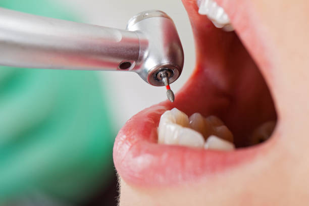 Best Emergency Care for Gum Disease in Maypearl, TX
